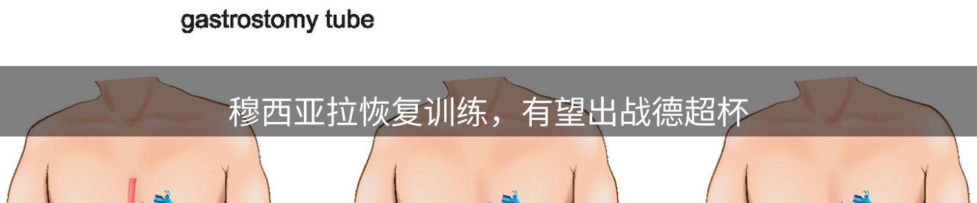 新闻播送